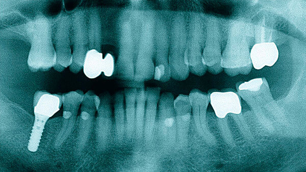 Abbildung 2: Radiologischer Ausgangsbefund |