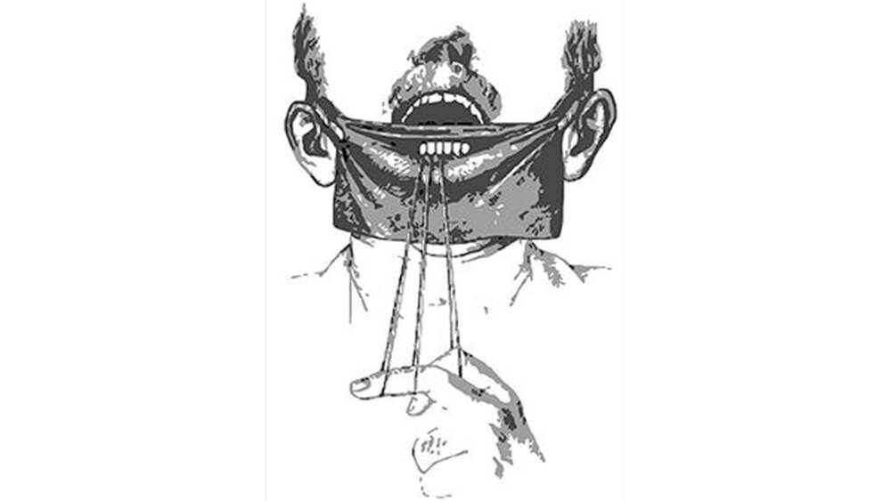 Fixierung 2: Bei der Technik nach Latimer musste der Patient – durch das Ziehen einer Schlinge – noch mithelfen bei der Fixierung. |