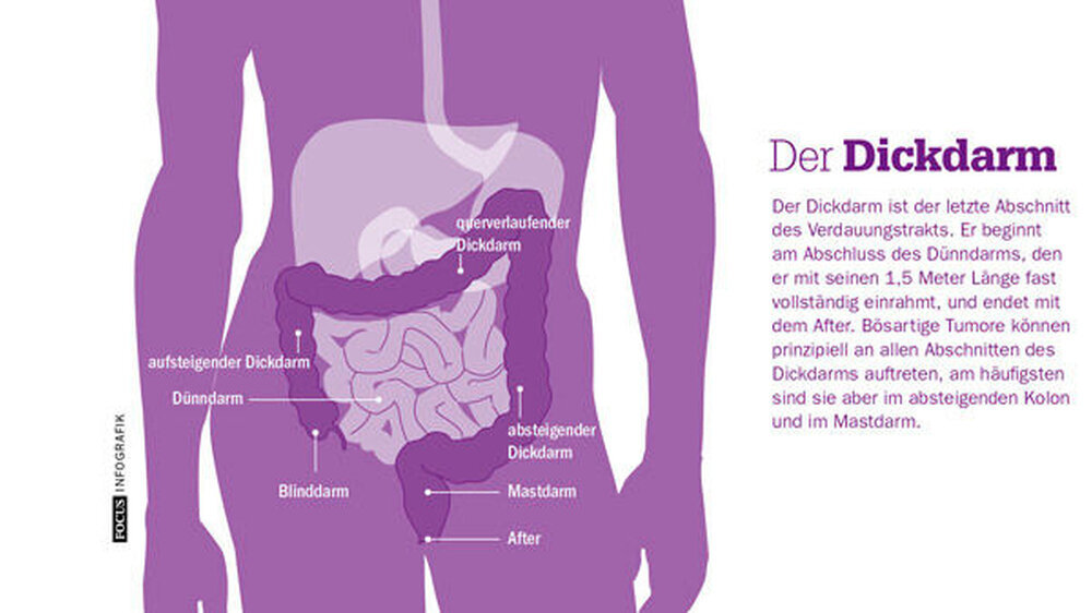 Die rückläufige Darmkrebsbehandlung in den Kliniken liegt an dem Wert der Früherkennung, sagt Rolf-Ulrich Schlenker Vizechef der Barmer GEK. Er will deshalb in Bayern ein individualisiertes Einladungsverfahren testen.