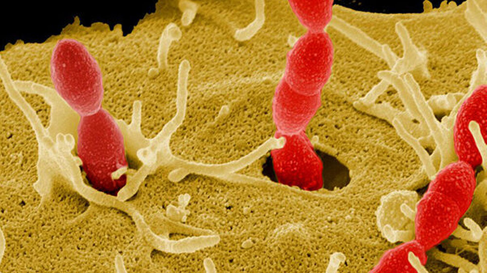 Streptococcus gordonii (rot) hat offenbar eine Schutzfunktion gegenüber dem Parodontitiskeim P. gingivalis, der in orale Epithelzellen eindringt.
