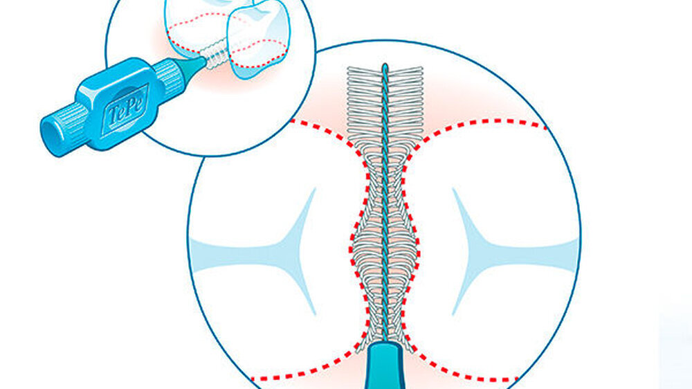 Mit vielen besonderen Merkmalen sorgen die Interdentalbürsten von TePe für die Gesundheit von Zähnen und Zahnfleisch, aber wirken auch positiv auf die Allgemeingesundheit ein.