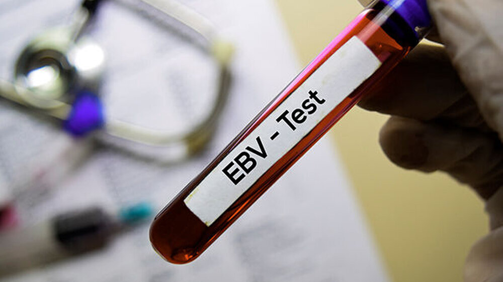 Unterschiedliche Virustypen können beim EBV für unterschiedliche Erkrankungen verantwortlich sein.