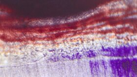 Die Legende heißt: Direkte Pulpaüberkappung mit Calciumhydroxid am Schneidezahn der Ratte im Vitalmikroskop nach 11 Tagen. Normalisierte Mikro- und Makrozirkulation im unteren Teil an Prädentin und tubulärem Dentin. Neubildung von Kapillaren der Mikrozirkulation am Prädentin unterhalb der Pulpaperforation, abgedeckt mit Calciumhydroxid.