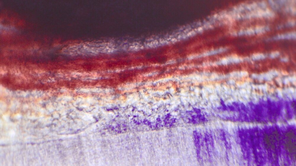 Die Legende heißt: Direkte Pulpaüberkappung mit Calciumhydroxid am Schneidezahn der Ratte im Vitalmikroskop nach 11 Tagen. Normalisierte Mikro- und Makrozirkulation im unteren Teil an Prädentin und tubulärem Dentin. Neubildung von Kapillaren der Mikrozirkulation am Prädentin unterhalb der Pulpaperforation, abgedeckt mit Calciumhydroxid.