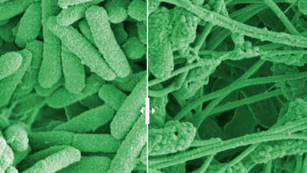 Mikroskopieaufnahmen zeigen die Veränderungen an Pseudomonas-Wundkeimen