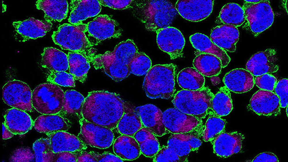 Expression von GLUT3 auf aktivierten T-Zellen. GLUT3 (grün) ist auf der Zelloberfläche lokalisiert – die Mitochondrien (violett) und der Kern (blau) wurden ebenfalls dargestellt.