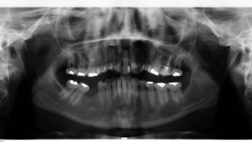 266939-flexible-1900 266939-flexible-1900