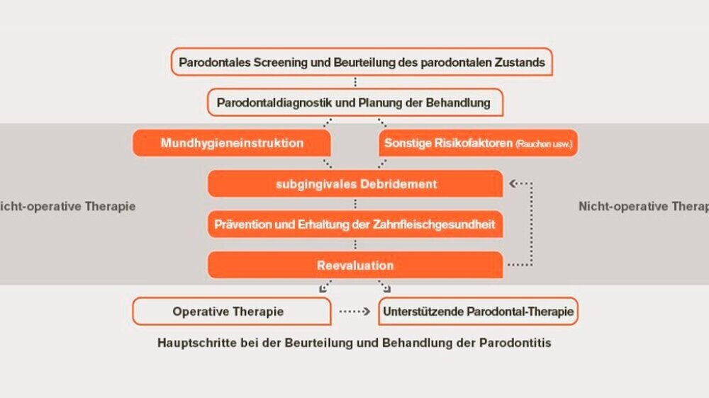 Management bei Zahnfleischerkrankungen wie beispielsweise Paradontitis. Weitere Informationen finden Sie auf dem Haleon Healthpartner Portal.