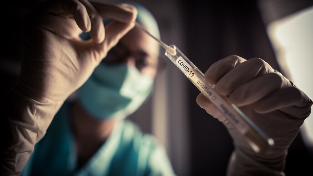 Der ALM e.V. (Akkreditierte Labore in der Medizin) warnt vor einer Überlastung der Labore. Derzeit werden bundesweit pro Woche knapp über eine Million SARS-CoV-2-Tests durchgeführt.