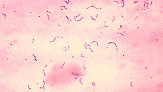 Streptococcus mutans (Gram-Färbung)
