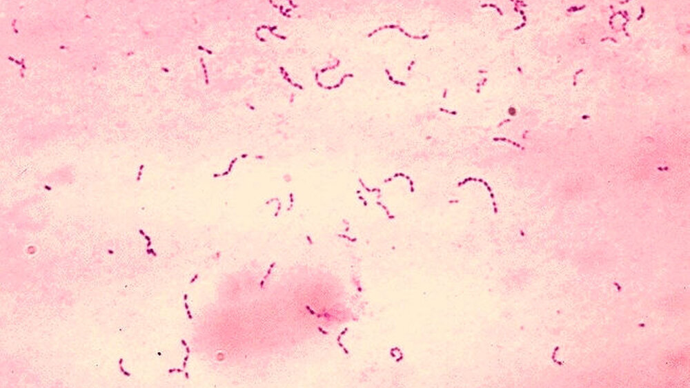 Streptococcus mutans (Gram-Färbung) Streptococcus mutans (Gram-Färbung)