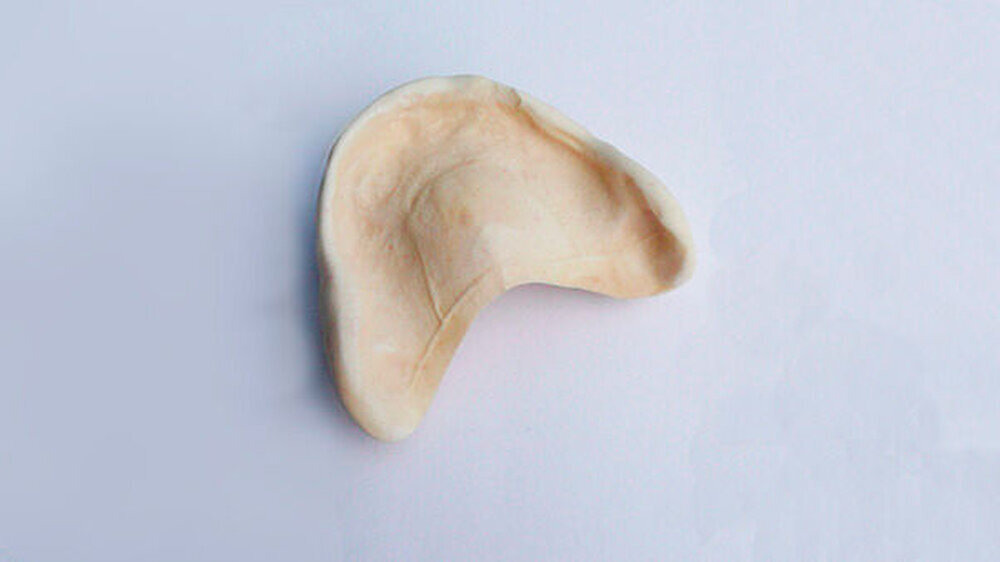 Die "Gaumen"ansicht der Albinoprothese