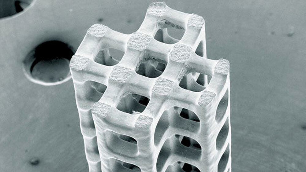 Abbildung 4: Prototyp eines resorbierbaren, individuellen Magnesiumimplantats für größere Knochendefekte |