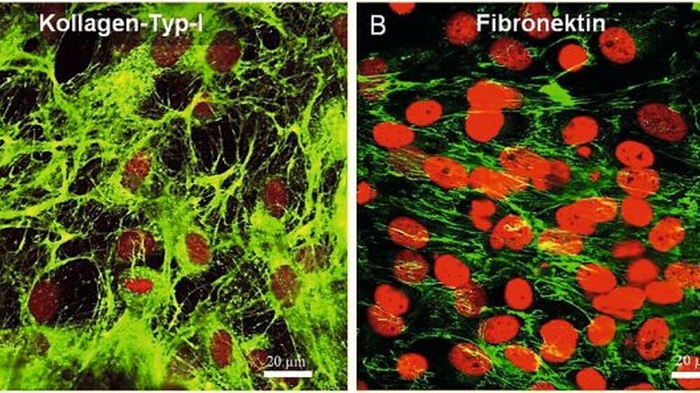 Abbildung 1: Die Grünfluoreszenz zeigt Moleküle der extrazellulären Matrix in Gingiva-Fibroblasten- Zellkulturen. Die Rotfluoreszenz markiert jeweils die Zellkerne. Maßstabsbalken 20μm. (A) Fibrilläres Kollagen vom Typ-I, (B) Fibronektin