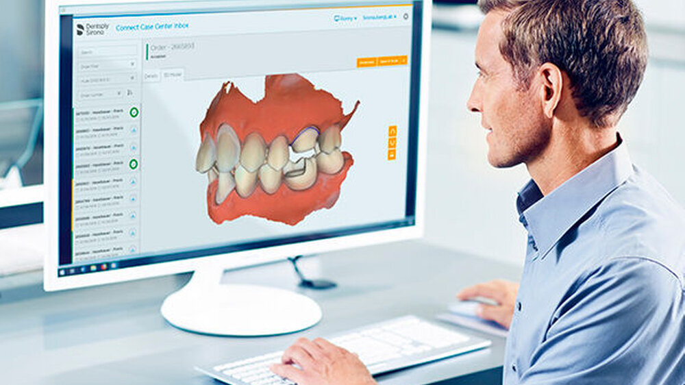 Ein einfacher Einstieg in die digitale Abformung und die CAD/CAM-unterstützte Zahnheilkunde: Mit Primescan von Dentsply Sirona, der neuen Connect Software sowie dem Connect Case Center gelingt dies mühelos.