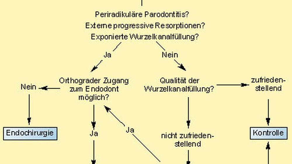 Abb. 1: Schema zur Entscheidungsfindung (aus Endodontie 1994; 3: S. 35)
