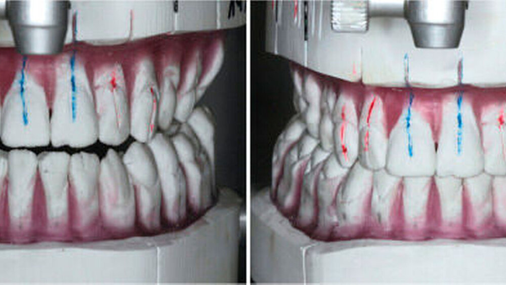 Abbildung 2: Praxisinternes Set-up (Dr. Schumann Partner, Essen) zur Simulation des Behandlungsergebnisses |