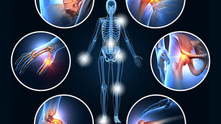 Osteoporose