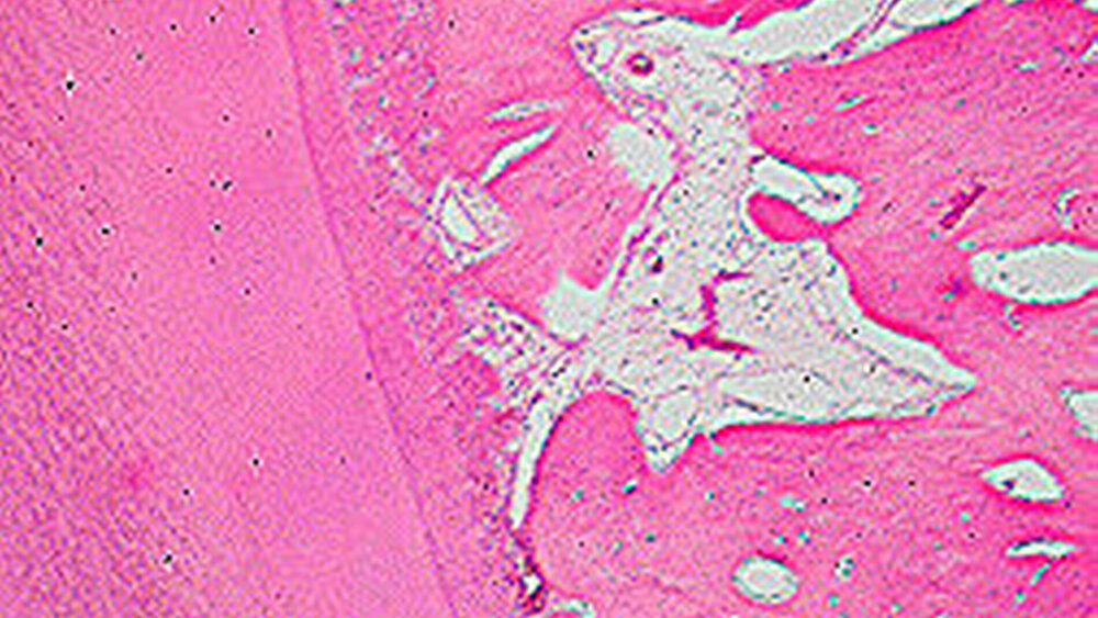 Abbildung 1b: Histologischer Längsschnitt eines Zahns – insbesondere Dentin und Wurzelzement zeigen eine dem Knochen vergleichbare prozentuale Zusammensetzung hinsichtlich der anorganischen und organischen Substanz (Tiermodell, Hämatoxylin-Eosin-Färbung). |