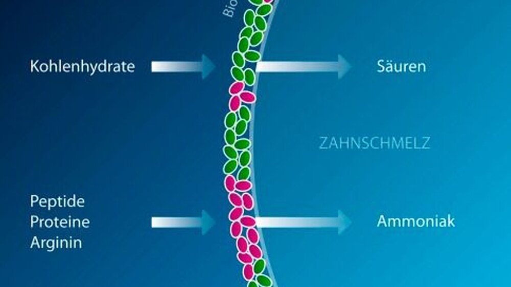 Abbildung 2: Ein kariogener Biofilm produziert bei hochfrequenter Zufuhr von niedermolekularen Kohlenhydraten organische Säuren. Dabei entsteht ein ökologisches Milieu, das durch azidurische und acetogene Keime dominiert wird. Durch die Zufuhr von Proteinen, Peptiden oder Arginin können einzelne Mikroorganismen Ammoniak produzieren und den pH-Wert im mikrobiellen Biofilm anheben. Dabei kann es in der Folge auch zur Etablierung eines weniger kariesauslösenden Biofilms kommen, in dem alkaliproduzierende Bakterien (in der Grafik rot) dominieren. |
