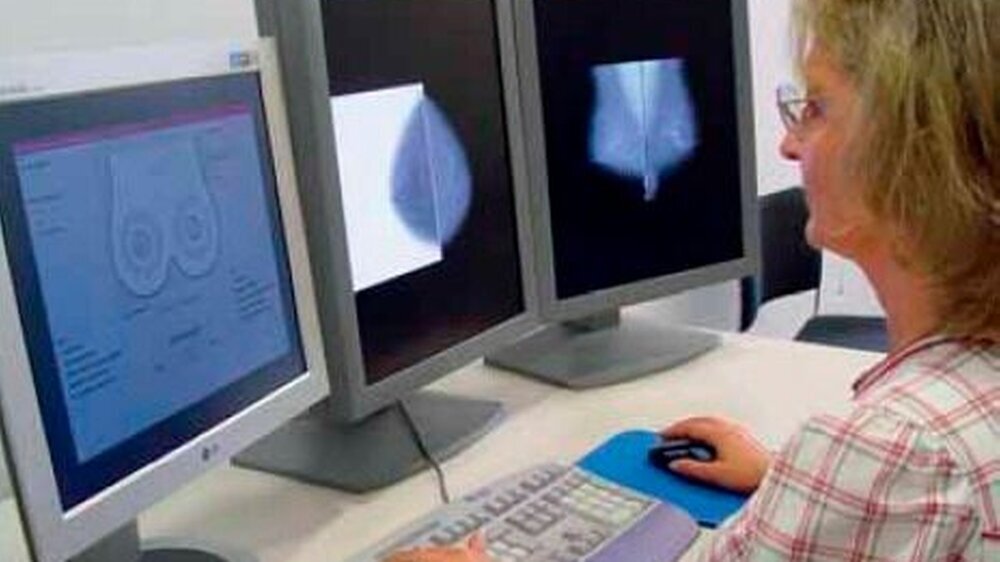 Röntgenärztin bei der Auswertung digitaler Mammographie- Aufnahmen