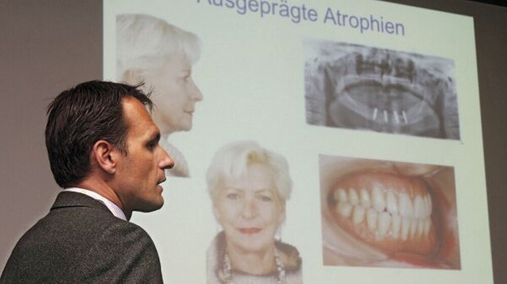 Oralchirurg Prof. Jürgen Hoffmann zeigt anhand von Fallbeispielen, wie und warum sich der Kieferknochen krankheitsbedingt zurückbildet und was Zahnärzte dagegen tun können.