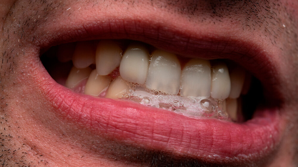 Image of man with open mouth, showing teeth Mann zeigt Zähne und Speichel