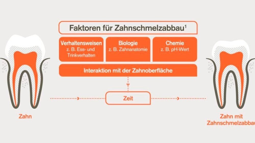 Unterschiedliche Faktoren können zu Zahnschmelzabbau führen. Sensodyne ProSchmelz kann dabei unterstützen dem entgegenzuwirken und vor weiterem Abbau schützen.