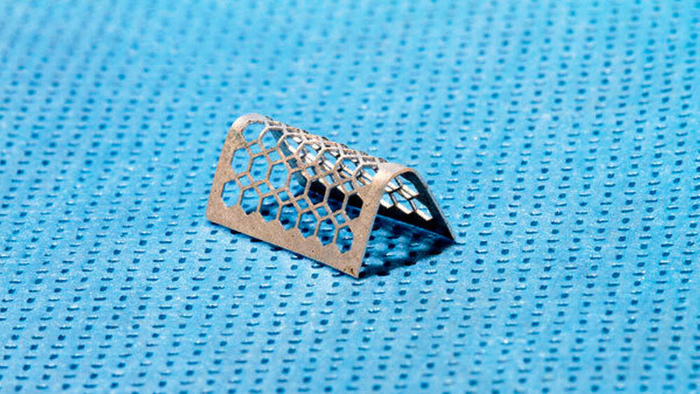 Abbildung 3: Resorbierbares Magnesium-Mesh |