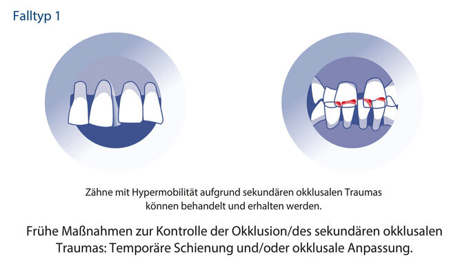 Falltyp 1_Abbildung 1.ai_master