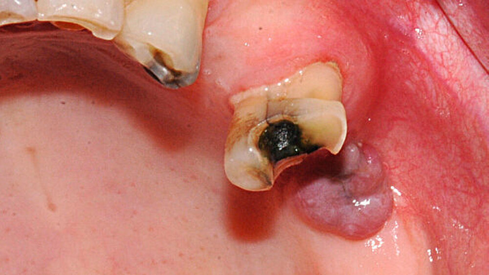 Abbildung 1: klinisches Bild zum Zeitpunkt der Erstvorstellung |