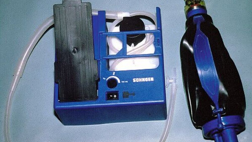 Absaugpumpe mit vorbestehendem technischen Defekt, der bei der ersten Benutzung zur Funktionsunfähigkeit der Pumpe führte. |