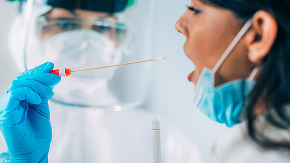 Mit dem zweiten Pandemiegesetz sollen künftig auch für Tests zur Früherkennung einer Coronavirusinfektion die Kosten übernommen werden.