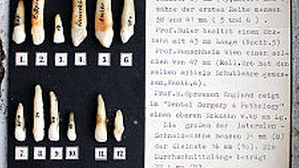 Wissenschaftlich aufgearbeitete Tafel aus dem ehemaligen Dentistischen Institut Wien: Darstellung der längsten Frontzähne |
