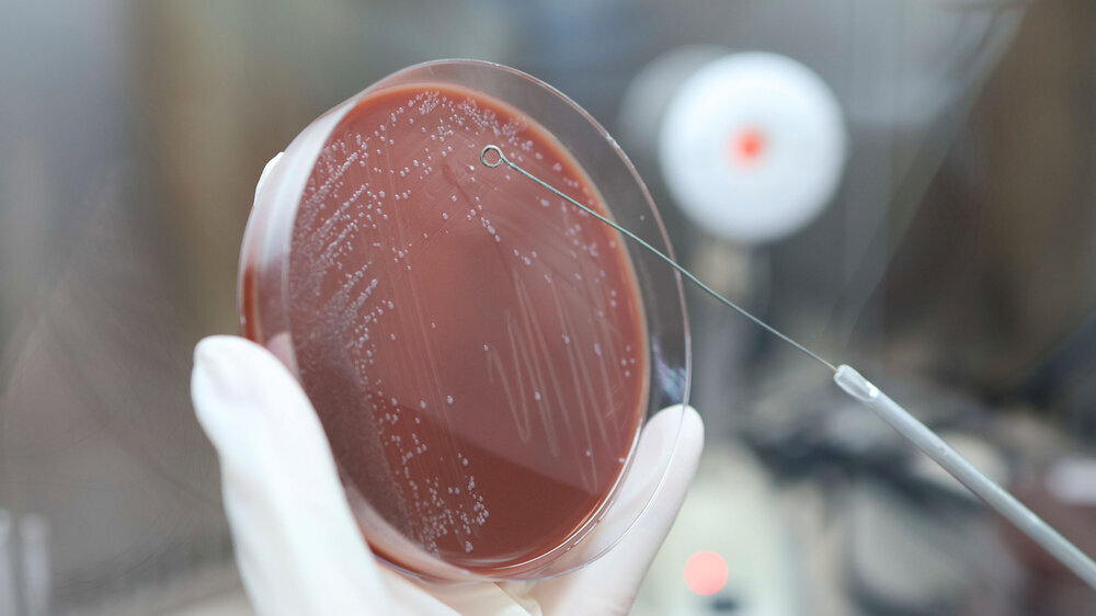 A research laboratory staff Streak colony on culture medium test for antibiotic resistance, Drug resistant gonorrhea, 4K footage. Antibiotika-Resistenzen
