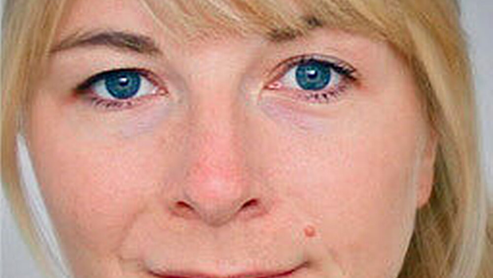 Dr. Anne Kruse - 1982 geboren in Lahnstein, Deutschland, 2002 bis 2008 Studium der Zahnheilkunde an der Albert-Ludwigs-Universität Freiburg, 2008 Zahnärztliche Approbation, 2008 Promotion, 2008 bis 2011 Assistenzzahnärztin und angestellte Zahnärztin in zahnärztlicher Praxis, seit 2011 Zahnärztin und wissenschaftliche Mitarbeiterin der Sektion Parodontologie, Klinik für Zahnerhaltungskunde und Parodontologie Freiburg i. Br., seit 2016 Fachliche Koordination im Studiengang Master Parodontologie und Implantattherapie der Universität Freiburg |