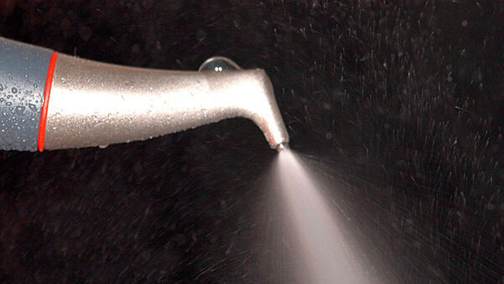 Sind abrasiv-pulverhaltige Präparate schädlich? Zur mechanischen Desintegration des subgingivalen Biofilms kommen in der Parodontitistherapie vermehrt Luft-Pulver-Wasserstrahlgeräte zum Einsatz. Doch wie risikoreich ist das Verfahren? |