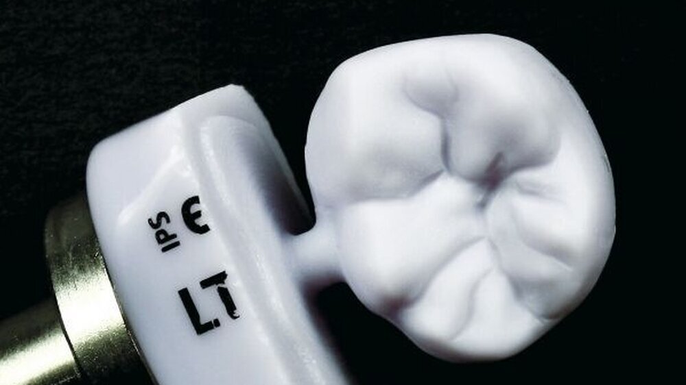 Abbildung 1: Krone aus IPS e.max CAD in aktueller Schleifstrategie von absolute Ceramics: Es resultieren eine seidenmatte Oberfläche und ein detailliertes Fissurenrelief.