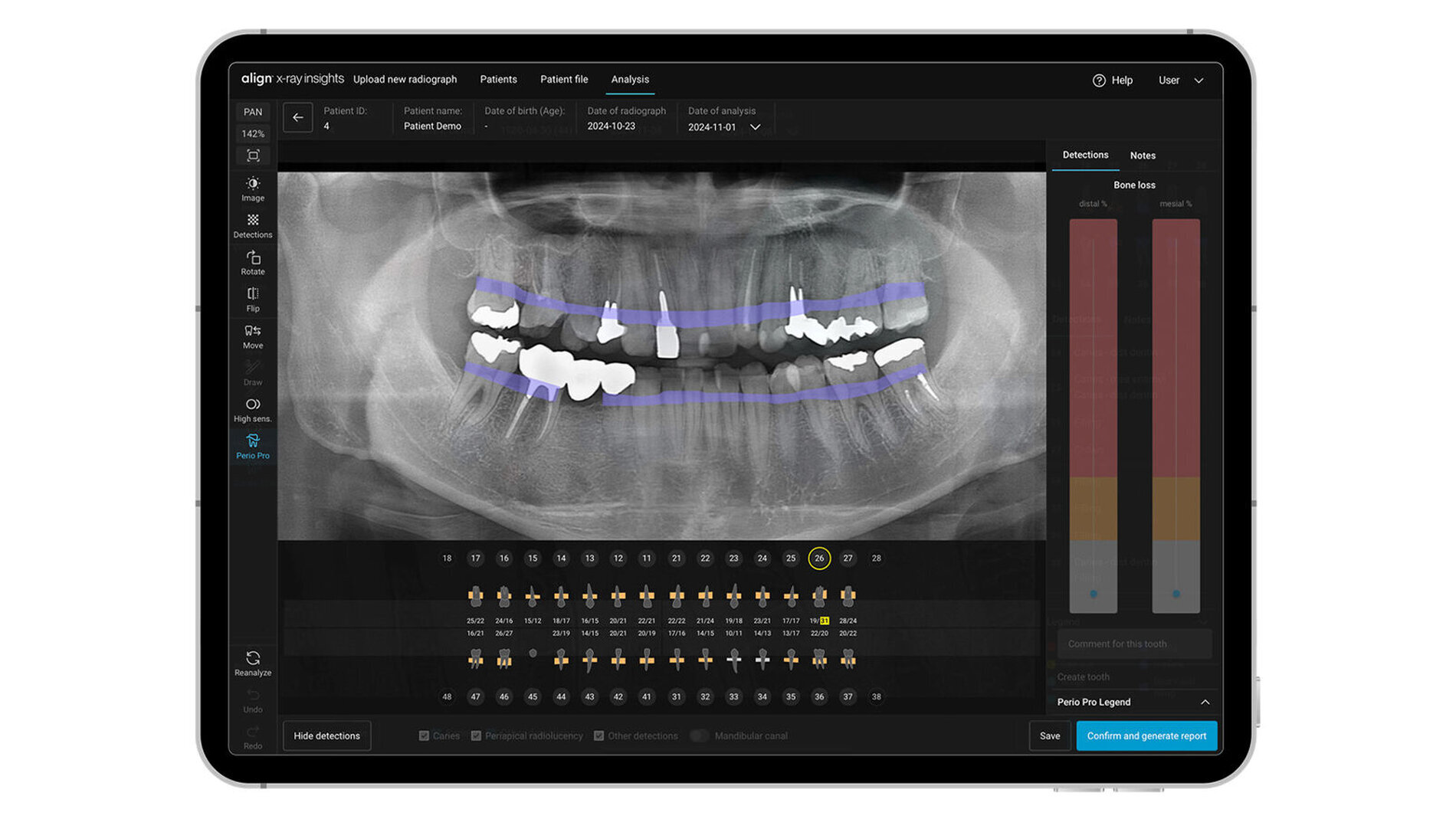 X Ray Alignment Align X-ray Insights - zm-online
