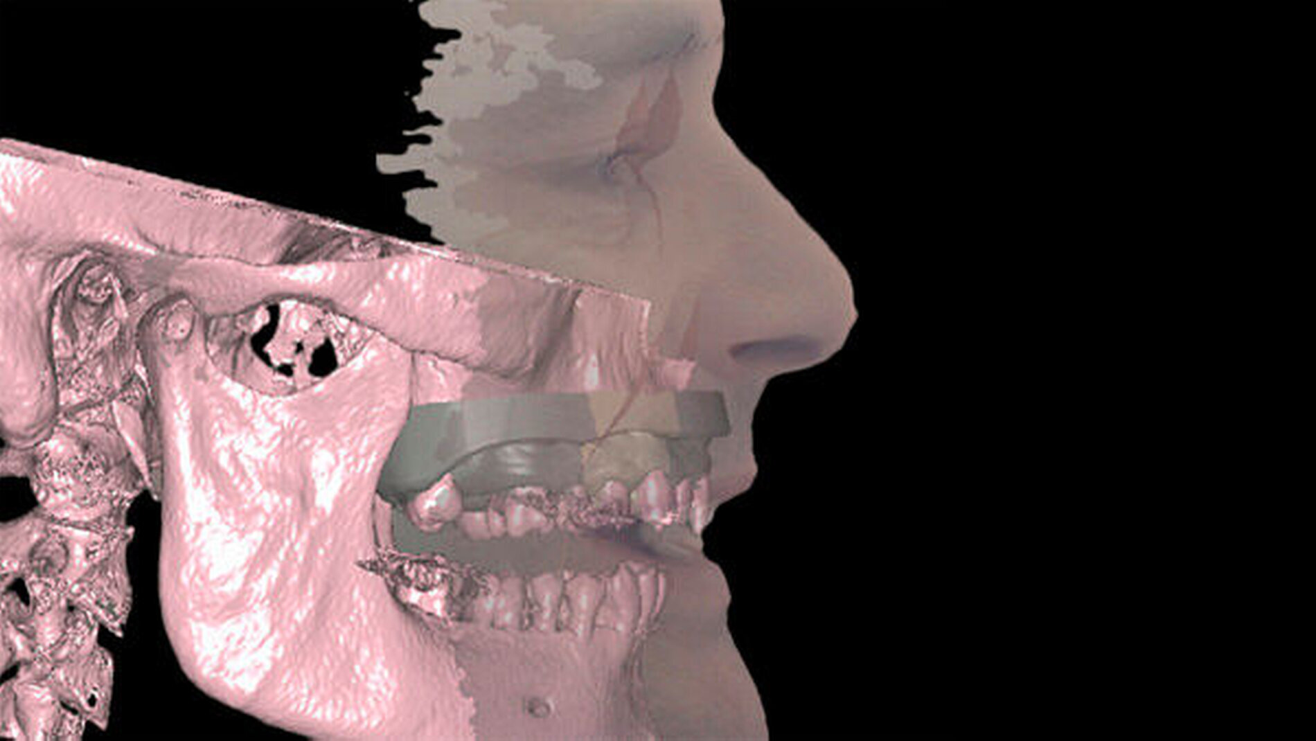 Fotorealistisch scannen mit dem Gesichtsscanner "Face Hunter"