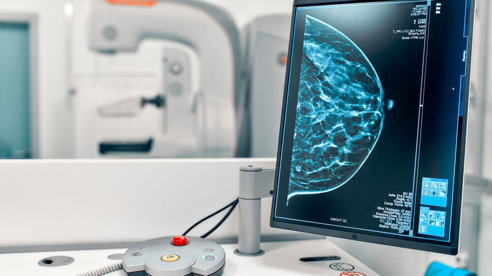 Mammogram snapshot of breasts of a female patient on the monitor with undergoing mammography test on the background. Mammography test at the hospital. Medical equipment.