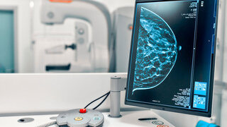 Mammogram snapshot of breasts of a female patient on the monitor with undergoing mammography test on the background. Mammography test at the hospital. Medical equipment.