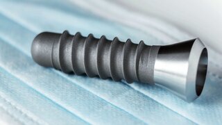 Implantat