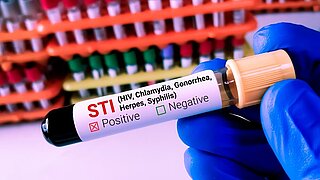 STI Sexually Transmitted Infection sexuell übertragbare krankheit