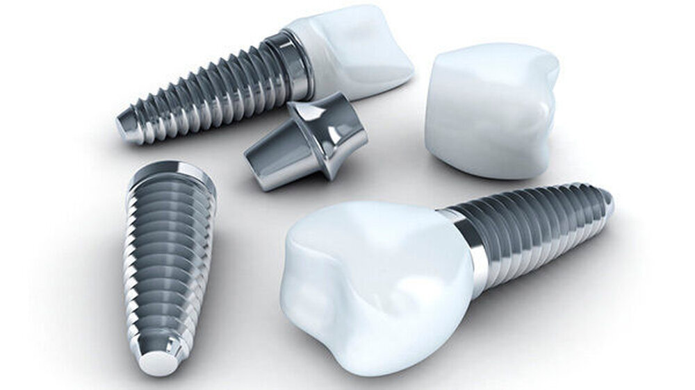 Kürzer, dünner, schneller, weißer - das sind die vier Adjektive, die zurzeit die Diskussion um Implantate bestimmen.