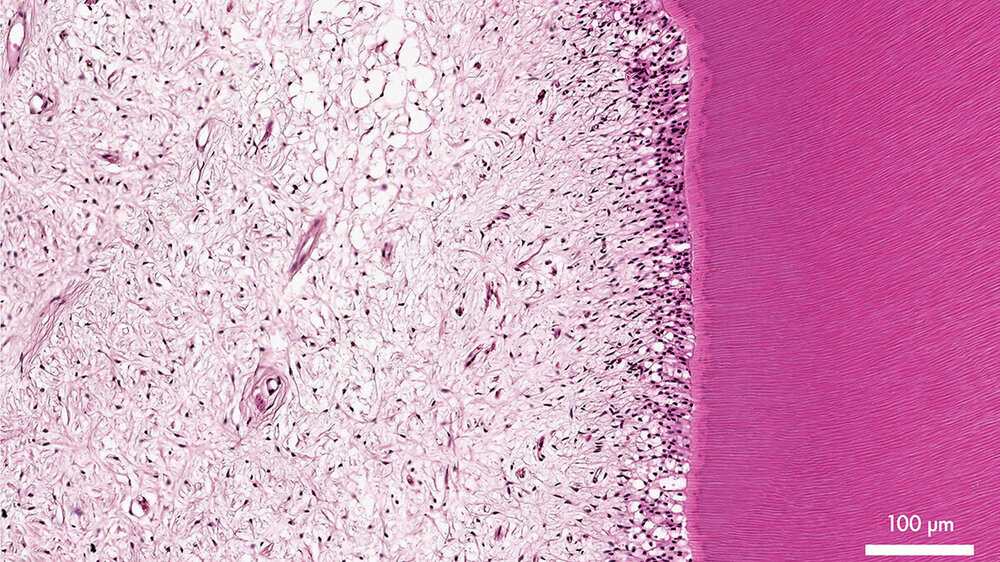 Abb. 1: Struktur der gesunden Pulpa, Hämatoxylin-Eosin-Färbung: Erkennbar ist das vaskularisierte Weichgewebe im Zahninneren, der Odontoblastensaum mit angrenzendem Prädentin und tubulärem Dentin.\r\n