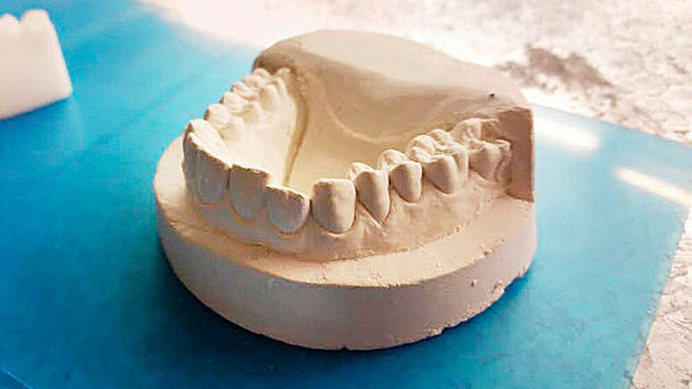 3. Der Alginat-Abdruck: „Diese Abformungen sind sehr präzise und erfassen eine erstaunliche Menge an Details. Zwar sieht man einige Luftbläschen, aber ich wusste: Die würde ich leicht entfernen können – sie haben keine Auswirkungen auf den Druckprozess“, schreibt Dudley. |