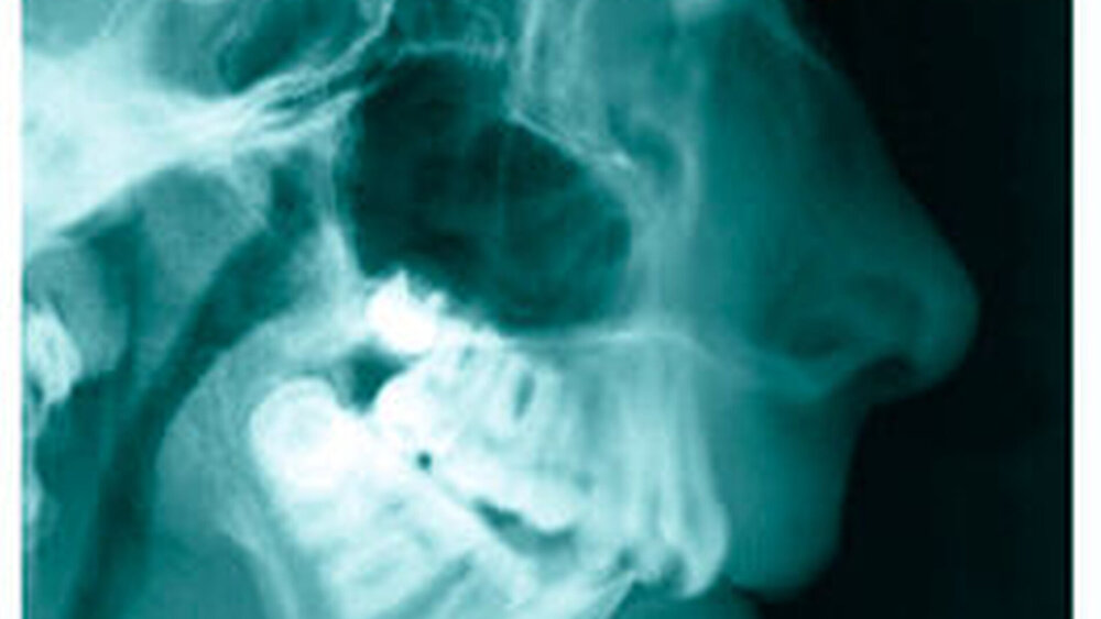 Abbildung 2a: FRS mit rheumatypischem Profil Abbildung |