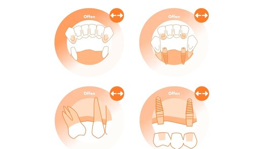 577819-flexible-1900 577819-flexible-1900