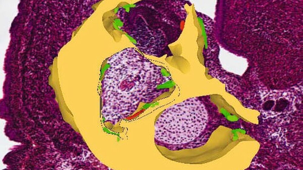Abbildung 1: Histologischer Vertikalschnitt durch die Anlageregion des ersten Molaren im Unterkiefer der Maus, Stadium E 15, Färbung: Hämatoxylin-Eosin. Darüber projeziert ist der umgebende Knochen der Region (ocker). Farbig markiert sind die Abbauregi